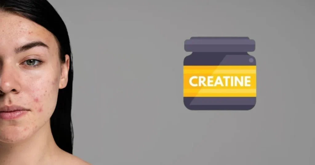 can creatine cause acne