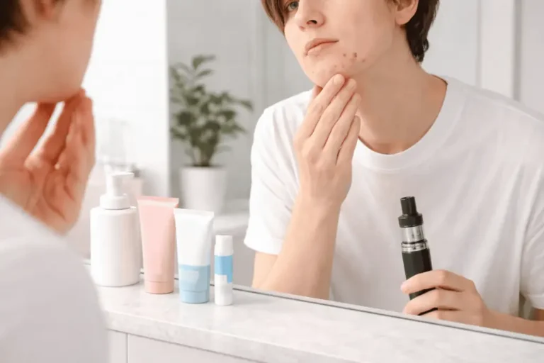 Can Nicotine Cause Acne